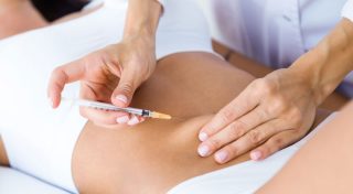 liposuction nasıl yapılır